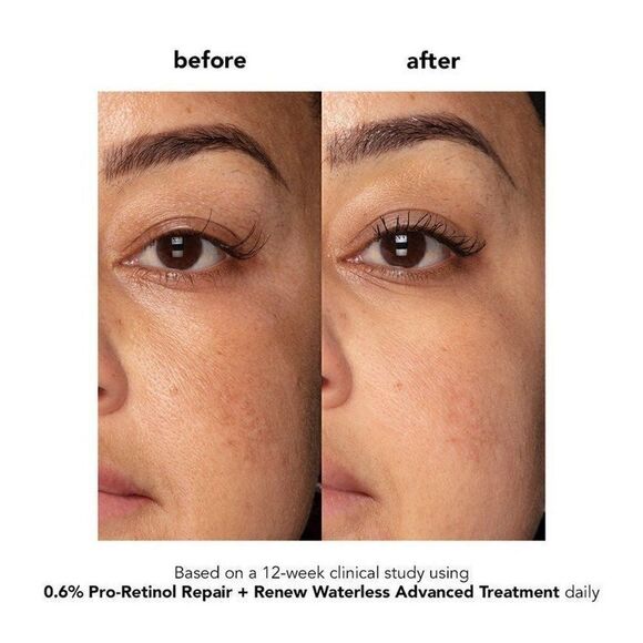 $25🌟 Boscia 0.6% Pro-Retinol Repair + Renew Waterless Advanced Treatment - Picture 3 of 6